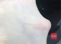 Illustration of how to make 65-degree soup hamburger embryos 7